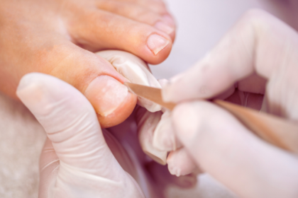 Combat Fungal Nails