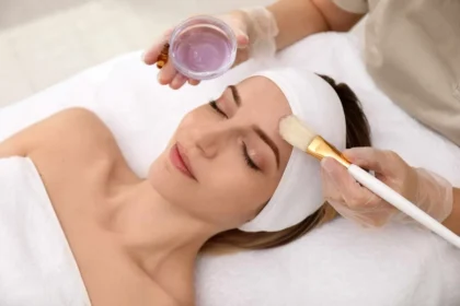 Getting a Chemical Peel