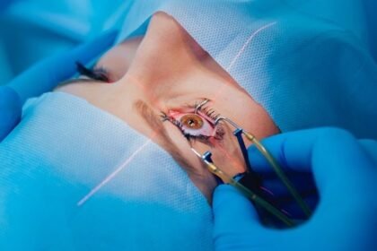 Enhancing Lasik Outcomes