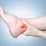 Ankle Injury Recovery