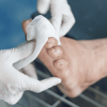 Diabetic Wound Care Solutions