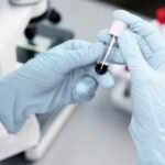 STD Screenings