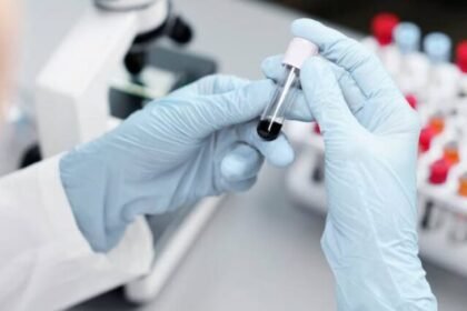 STD Screenings